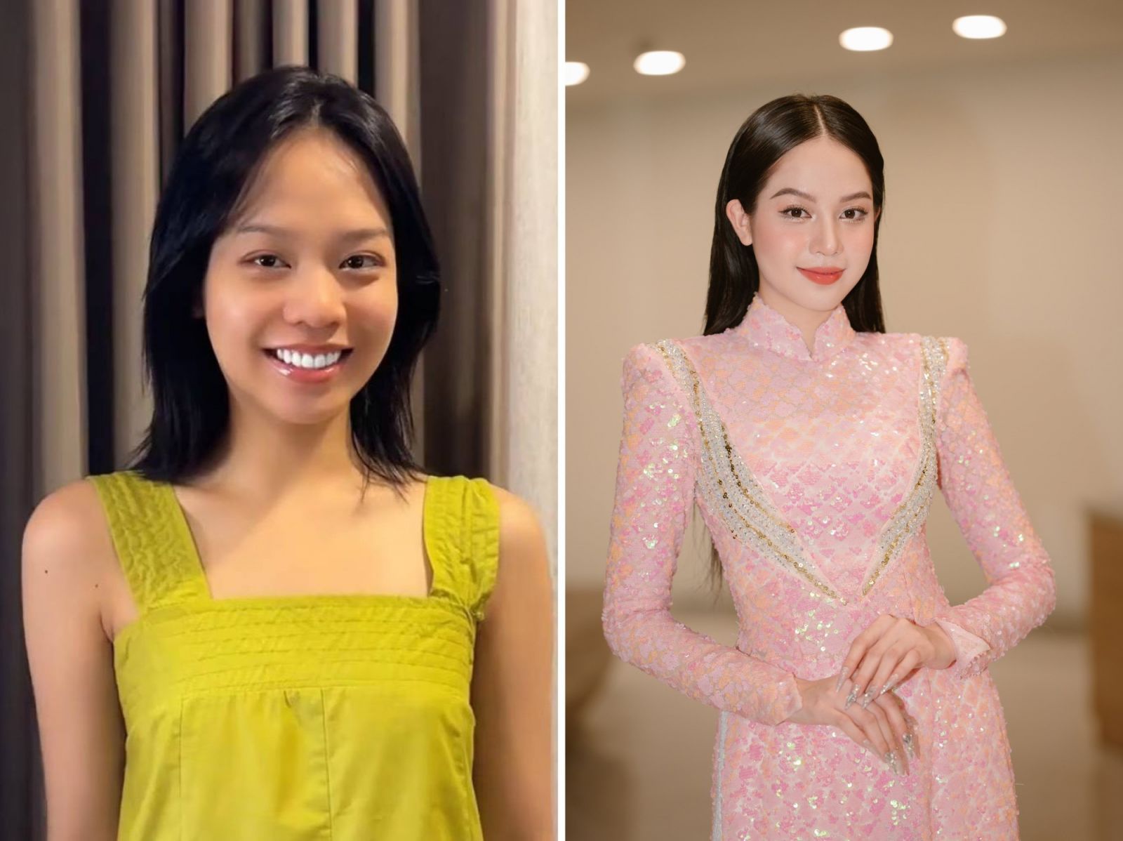Rò rỉ hình ảnh hoa hậu Thanh Thủy ở thẩm mỹ viện, can thiệp dao kéo?